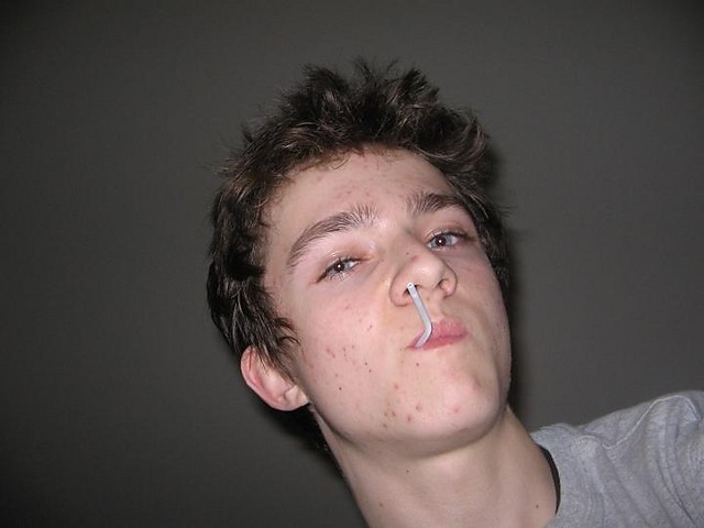 xd