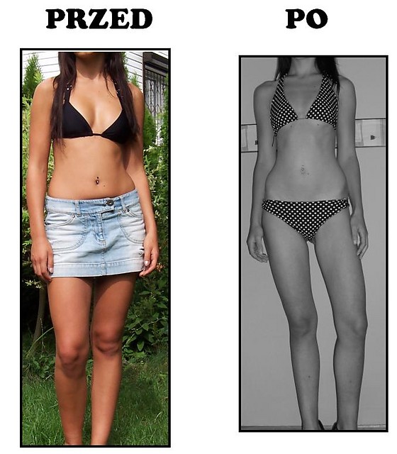 proana