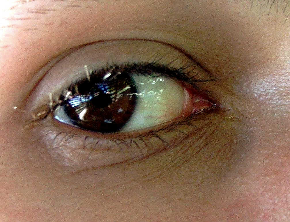 His eye :)