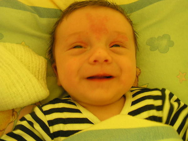 Tomecek:**