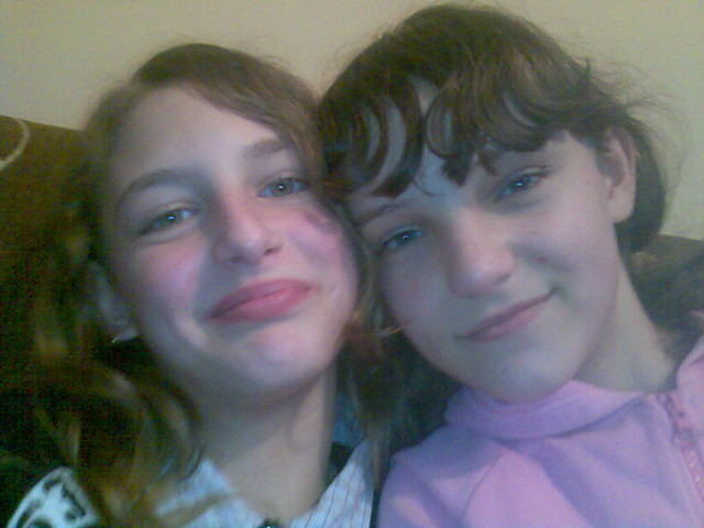staree x d