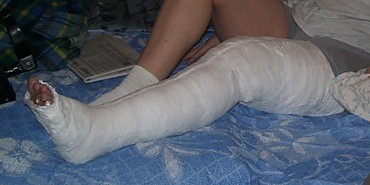 Gips nr 1