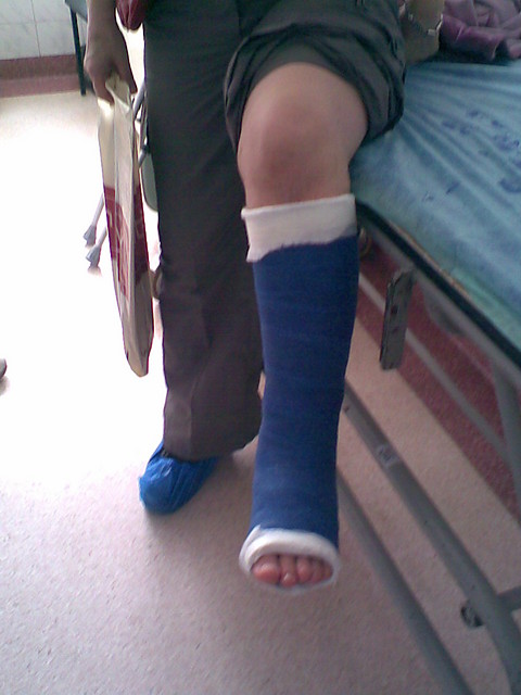 Gips nr 3