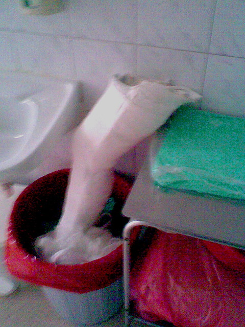 Gips nr 1 w lamusie