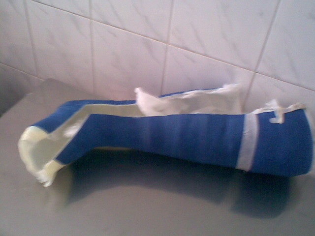 Gips nr 2 w lamusie