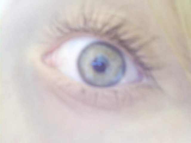 My eye