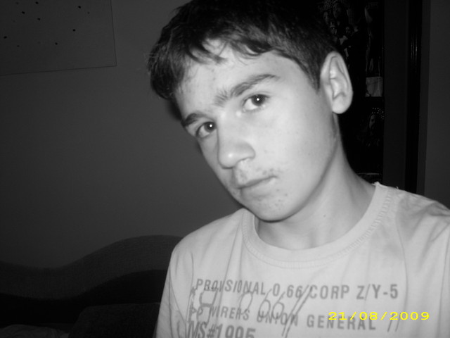 Z pryszczami jeszcze ;]