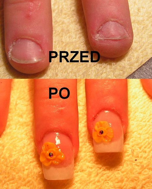 Przed i po
