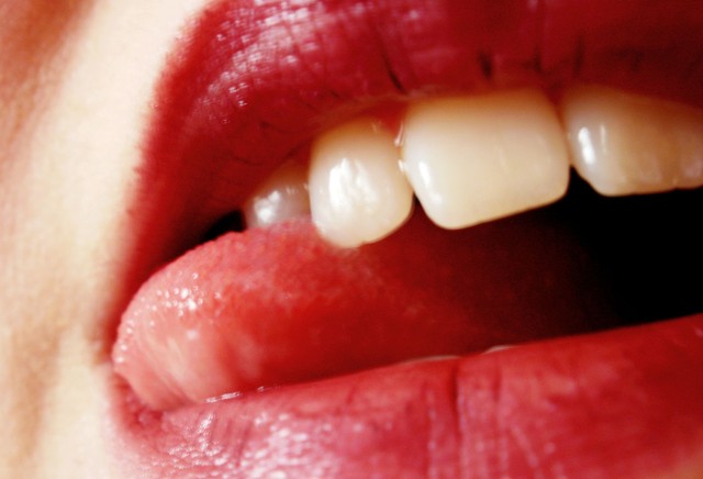 Kiss