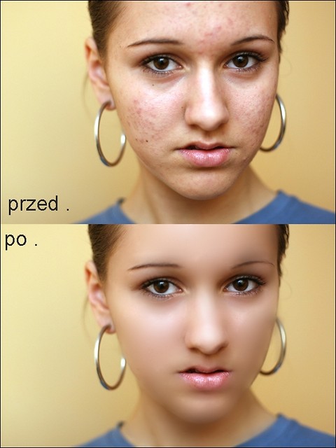 przerbka 1 .