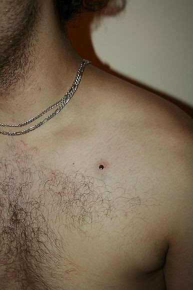 microdermal