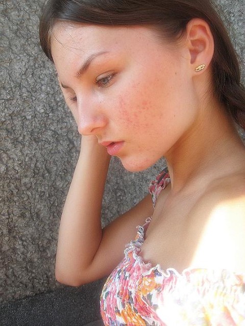 Lato lato lato !