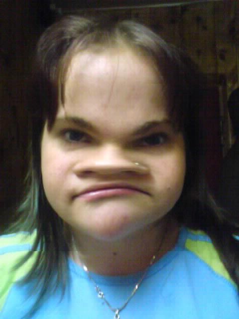 lol xD 