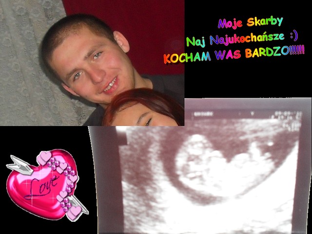 Moje Dwa Najukochasze Skarby :*