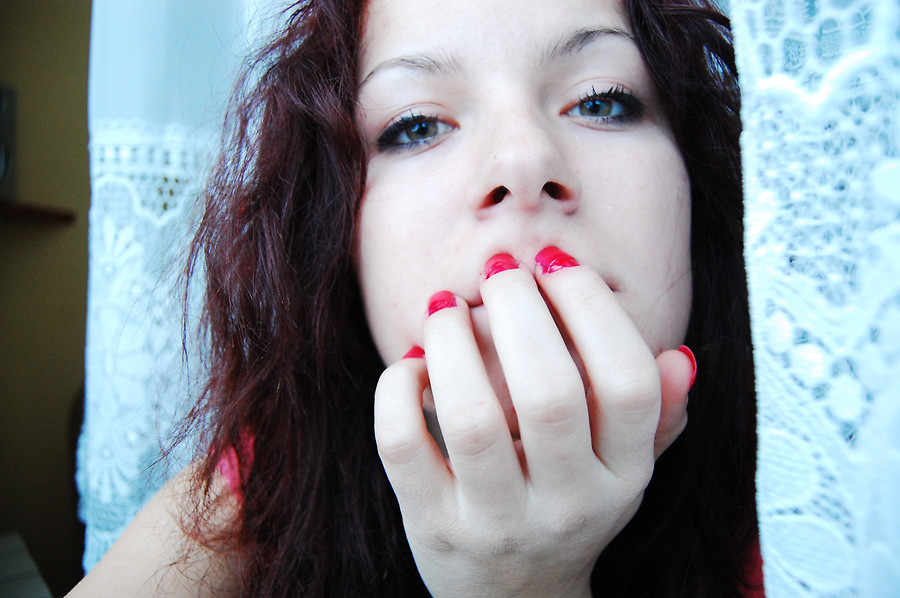 kiss