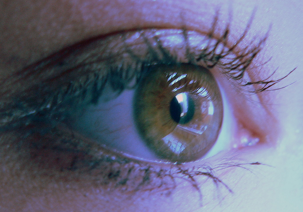 Eye