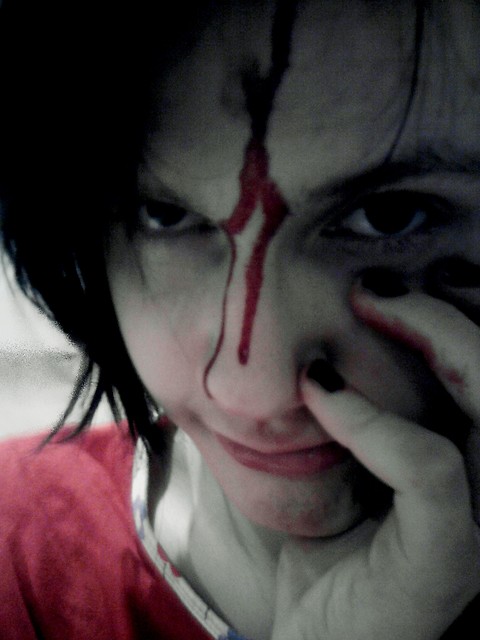 You watch me bleed. @@'