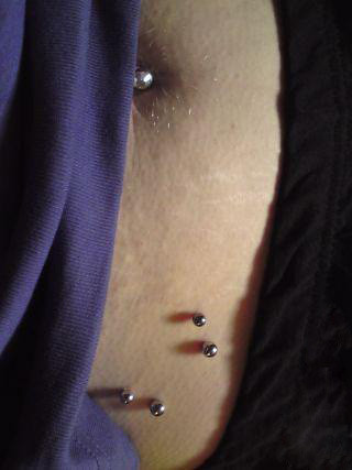 hip x2