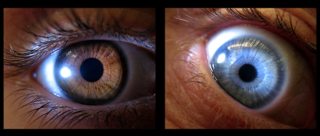 Eyes