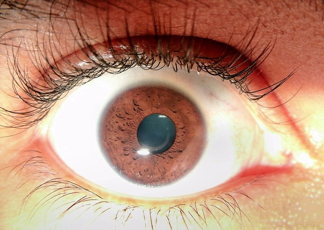 Eye