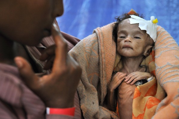 Etiopia