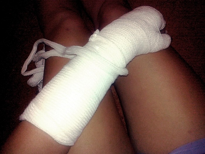 Gips