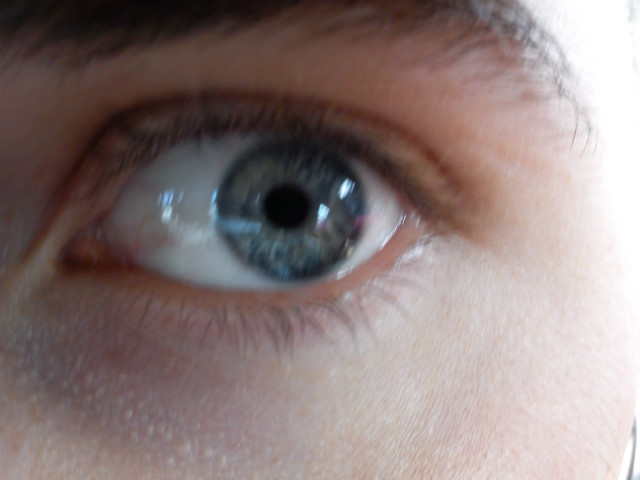 my eye