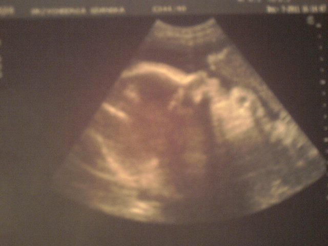 dzidzka.! < 33 