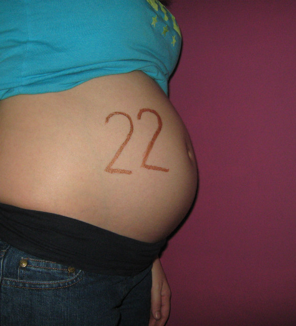 22:D