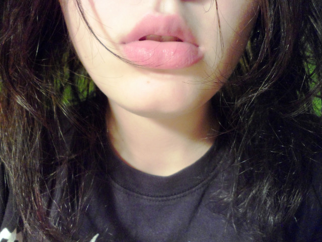 :*