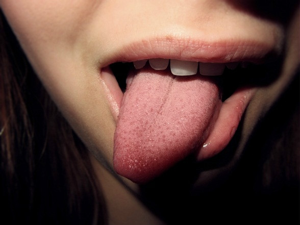 :*