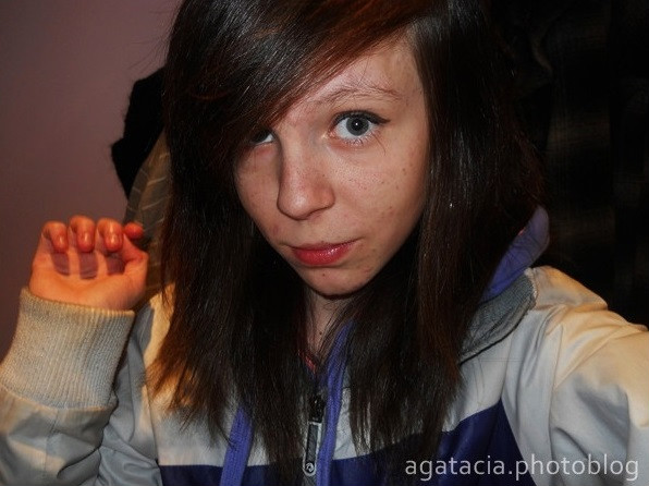 10. agatacia
