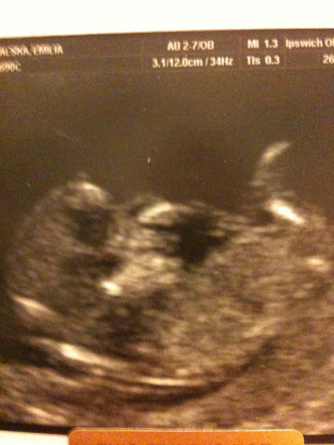 Our little lil bambino xxxxx 