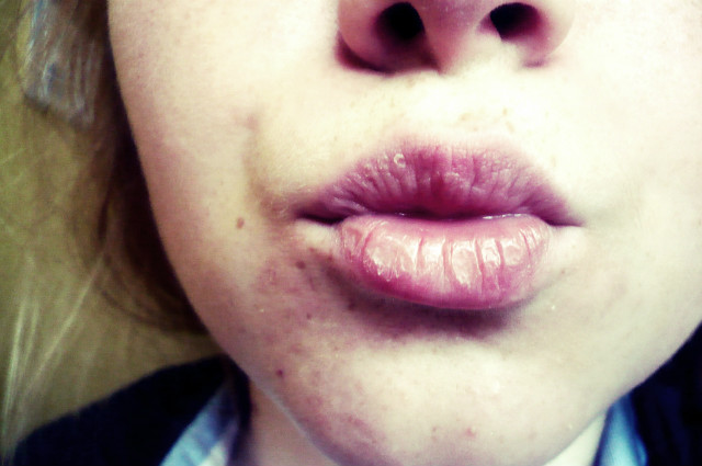kiss... kill