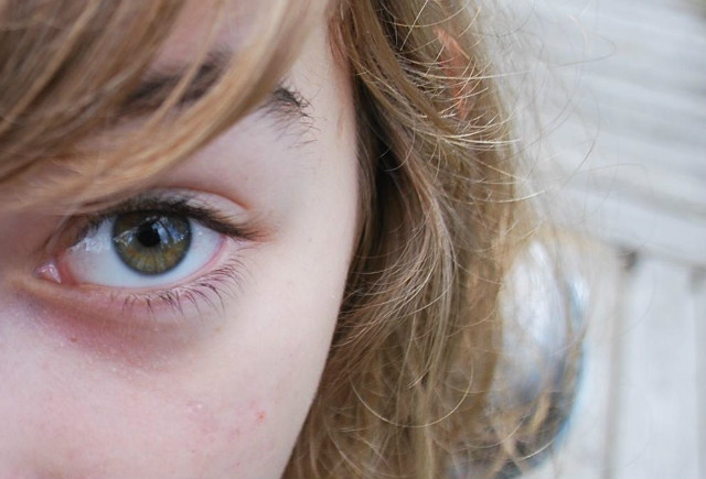 Girl with one eye