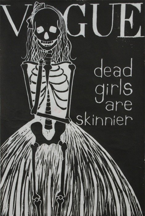 Anorexia . 
