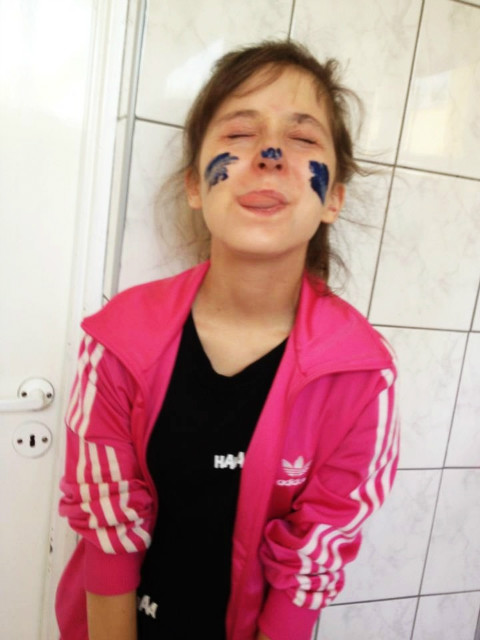 po plastyce XD
