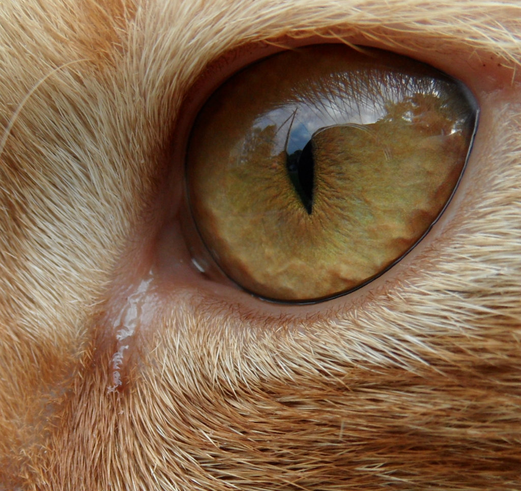 Eye