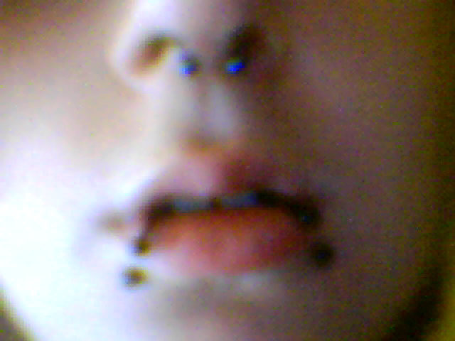 SEPTUM