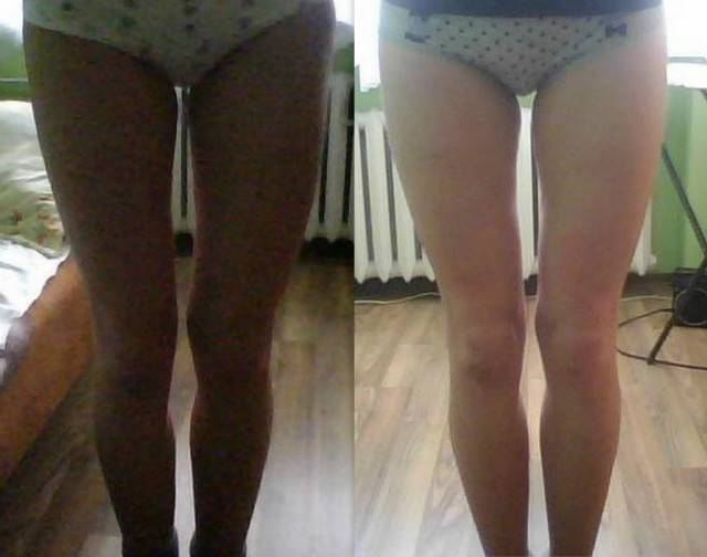 my legs.