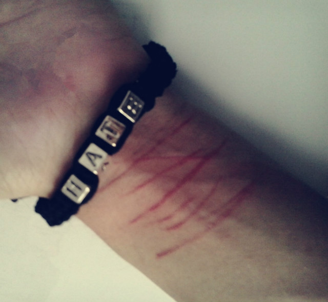 Hate.
