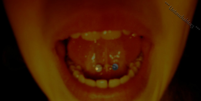 104 .
