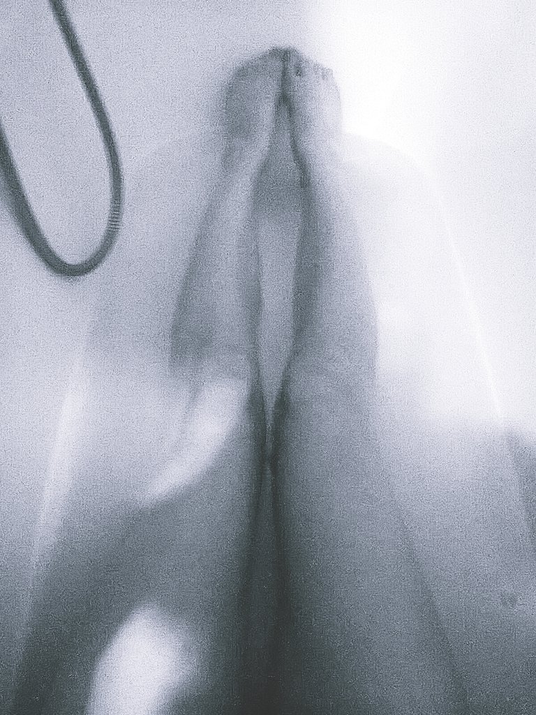 /1