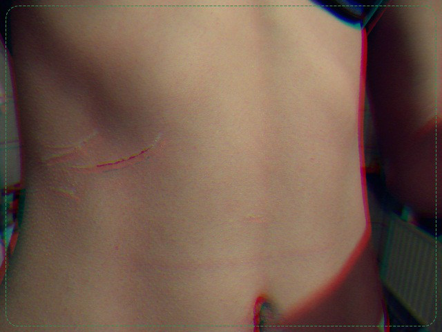 thekill