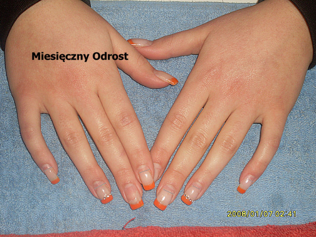Miesiczny Odrost 