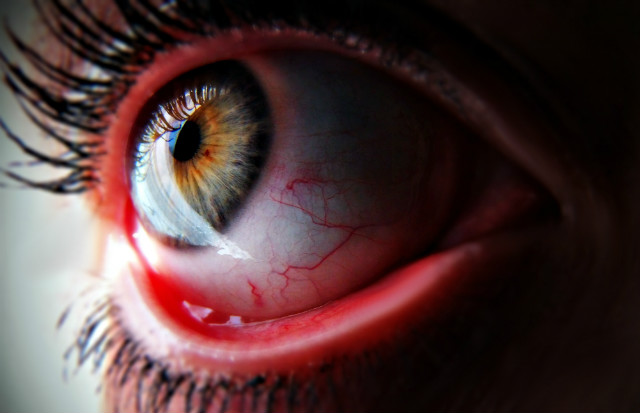 Scary eye. 