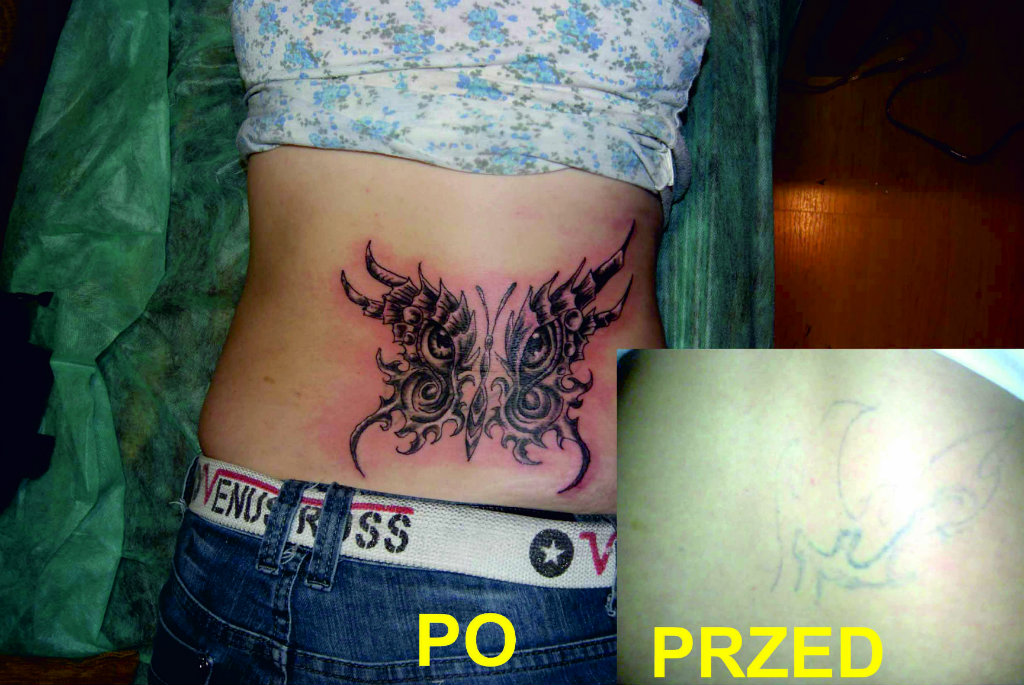 Przykrycie motyl ...
