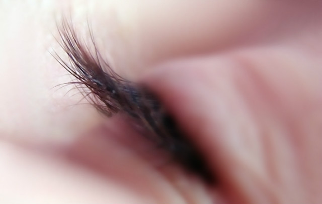 Eye.