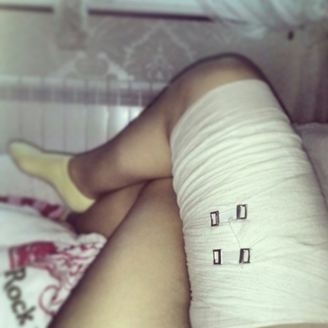 xtcdh