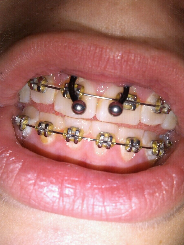smiley